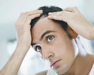 Alopecia areata, alopecia areata cauze si tratament