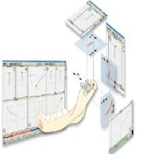 Aksiografiya (kondilografiya) в стоматологични индикации, същността на метода, оборудване