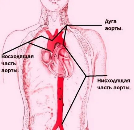 Гръдна аортна аневризма диагностиката и лечението