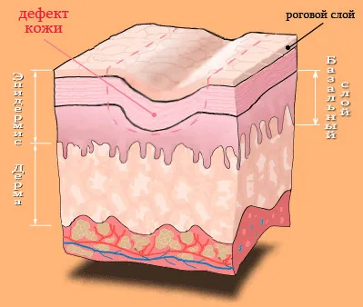 Rinnovamento alternativa non-invaziva resurfacing cu laser a pielii