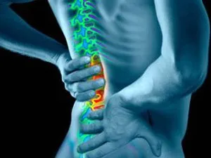 radiculopatie cervicală vertebrogena și simptomele coloanei cervicale si tratament