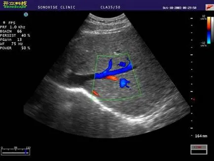 Ecografie Doppler a extremităților inferioare și pregătirea pentru ultrasunete vasculare