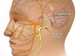 Възпаление на троичния нерв - признаци