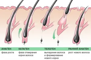 Alopecia la femeile tratate la domiciliu