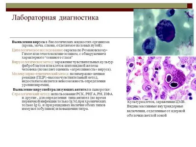 Citomegalovirus femei ce este, simptome si tratament al bolii la adulti, astfel cum a raportat