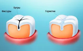 Stomatologie Pediatrica în Chelyabinsk, vitasmayl - o retea de clinici stomatologice