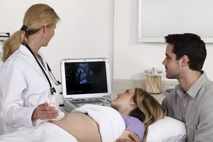 Foto Uzi gemeni la inceputul sarcinii, sarcina multipla
