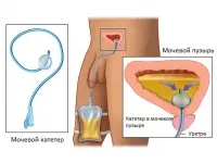 sanbyulleteni Ready, broșuri, broșuri, articole și prezentări privind prevenirea bolilor