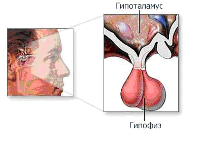 Хиперпролактинемия диагностика - лечение на сърдечна