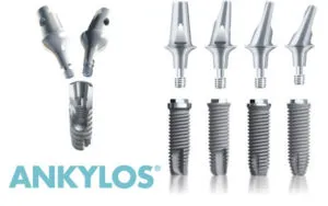 Имплантанти ANKYLOS ползи анкилоза импланти, цени, снимки