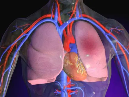 Tüdő- infarktus okai, tünetei, kezelés, prognózis, a következmények