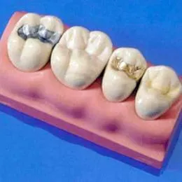 Какво прави един печат зъб, съставът на двете постоянни и временни тип