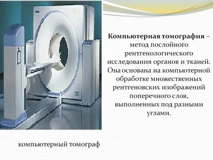 Компютърна томография - метод за наслояване на рентгенови лъчи - представяне 19973-10