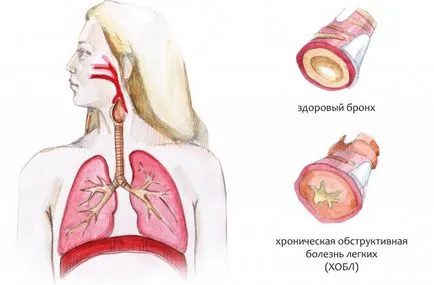 Lasolvan указания и препоръки за прилагането вдишване