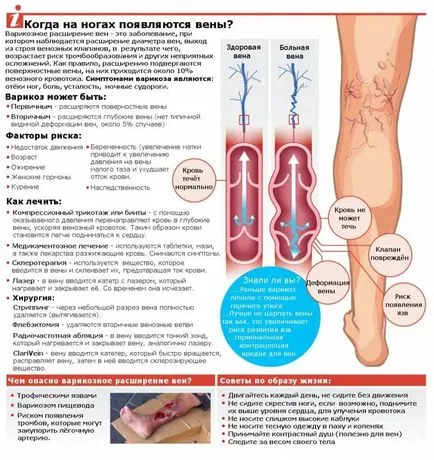 Kezelése thrombophlebitis tünetek, okok és kezelések