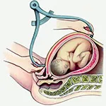 Mycoplasmosis, orvosi rendelő