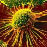 Termékek a rák megelőzésével - szike - orvosi információk és oktatási portál