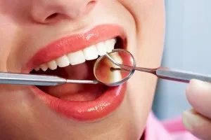 възстановяване на зъбите
