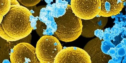 Staphylococcus aureus și simptomele sale, tratamentul și prevenirea stafilococice