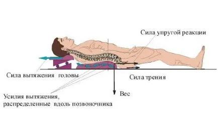 Simulator pentru întindere și se întinde pe spate și a coloanei vertebrale tipuri, indicații, contraindicații,