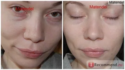 Ultrahangos tisztító az arc - „Mi az ultrahangos tisztítás, és aki meg tudja csinálni, ha hatékonyabban