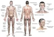 Tratamentul Vitiligo simptome foto care aceasta boala, cauzele