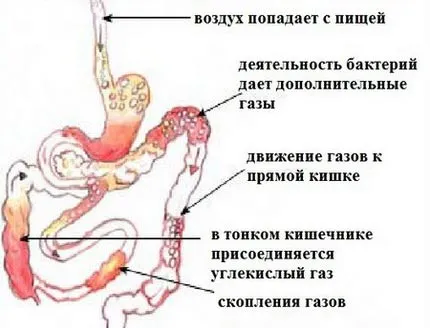 подуване на корема на детето причините, първа помощ, лечение и профилактика