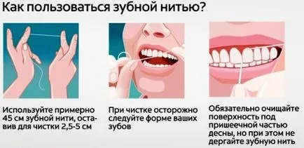 beneficiu ata dentara sau rău - experiența personală și comentarii ale persoanelor