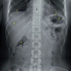 Mit és hogyan kell csinálni egy X-ray a hasüreg előkészítése, ár