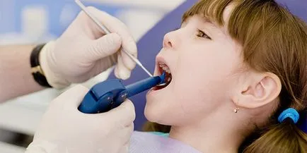 Üveg tej fogak fogszuvasodás gyermekeknél okoz és kezelés