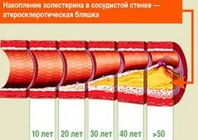 Обувки съдове народни средства