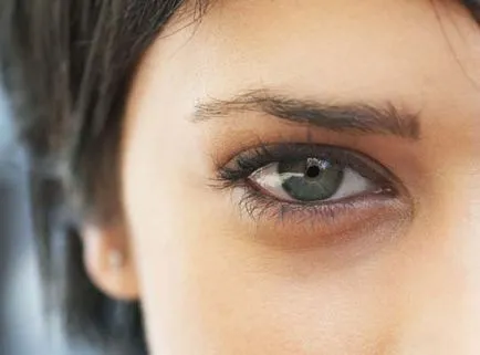 Cum putem elimina cercurile intunecate din jurul ochilor câteva sfaturi și rețete de casă