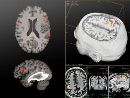 Mi jobb CT vagy MRI agyi képalkotó különbségek