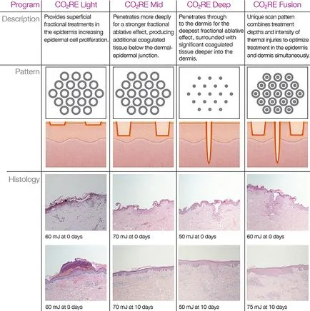 Co2 cosmetologie cu laser