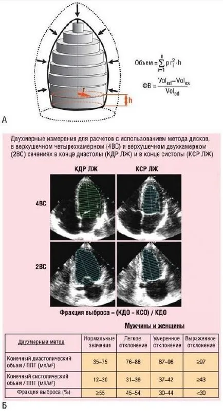 Ecocardiografia funcția sistolică ventriculară stângă