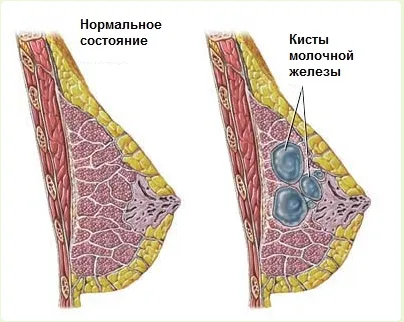 sân shotty