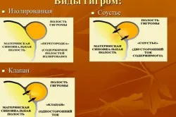 Simptomele higroma și tratament