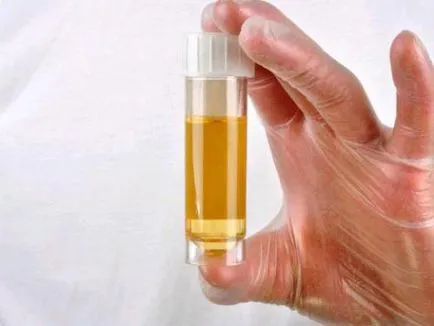 Cum să scapi de mirosul de urină în apartament, decât să-l eliminați la domiciliu