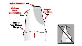 Dental-revue, articole ortopedice, în special pregătirea dinților sub coroane artificiale cu