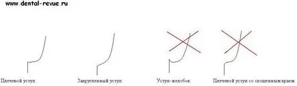 Dental-ревю, статии, ортопедични, особено за получаването на зъбите под изкуствени корони с