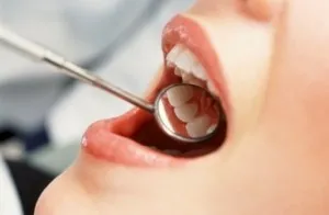 Osztályozása fogszuvasodás - talán a legjobb hely a fogászatban