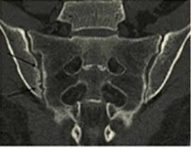 Computer si rezonanta magnetica imagistica in diagnosticarea precoce a sacroiliitis, publicare