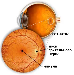 Macula okok, tünetek, kezelés makulita 1