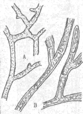 Morfologia fungi filamentoși de ciuperci