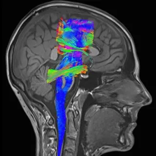 MRI с контрастни (контраст) цени за Магнитна томография