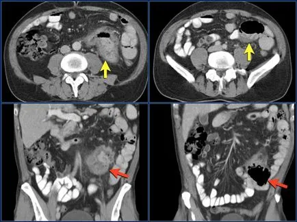 червата MRI (сканиране), която показва подготовката за проучване, цена