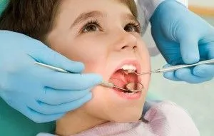 Malocluzie copilului la ce vârstă a pus aparat dentar