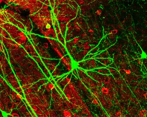 Neuron (biologie) - este