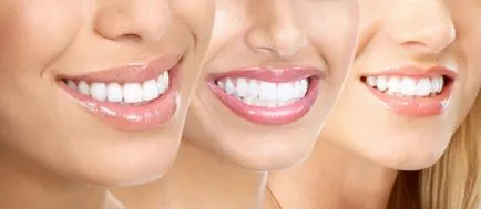 Незабавно поставяне на импланта при премахването на зъбите плюсовете и минусите на услуги - статии за стоматология