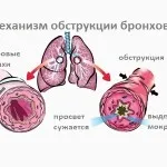 Остра дихателна недостатъчност причините и симптомите